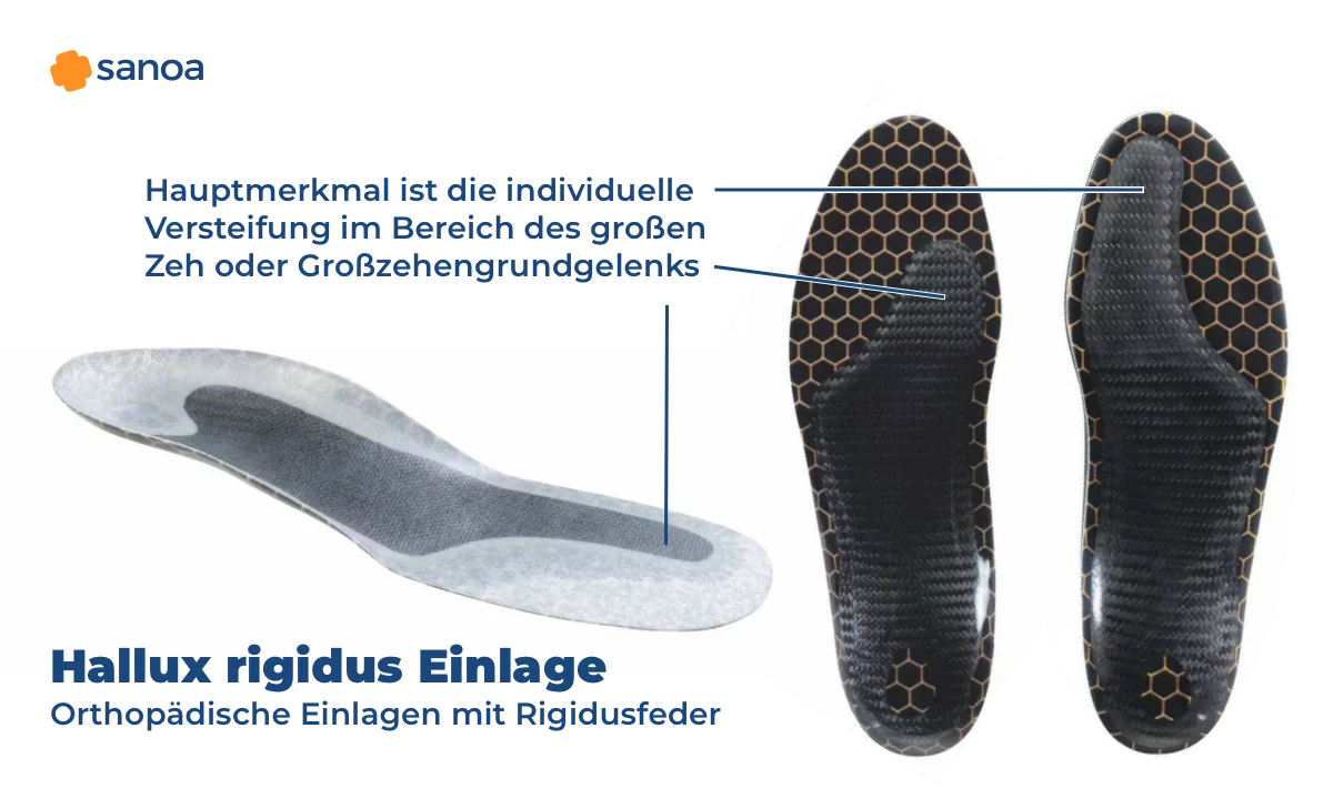 Hallux Rigidus: Was Sie unbedingt tun sollten, wenn der groe Zeh steif  wird.