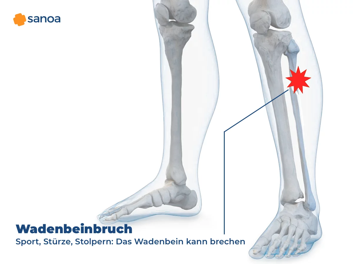 Schien Und Wadenbeinbruch Wie Lange Krank